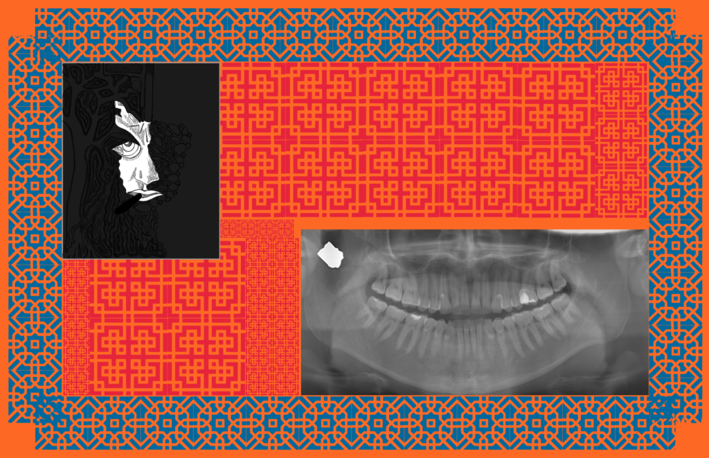 Artistic depiction of a shooting incident showing an individual with an X-ray image highlighting a bullet lodged in their head.
